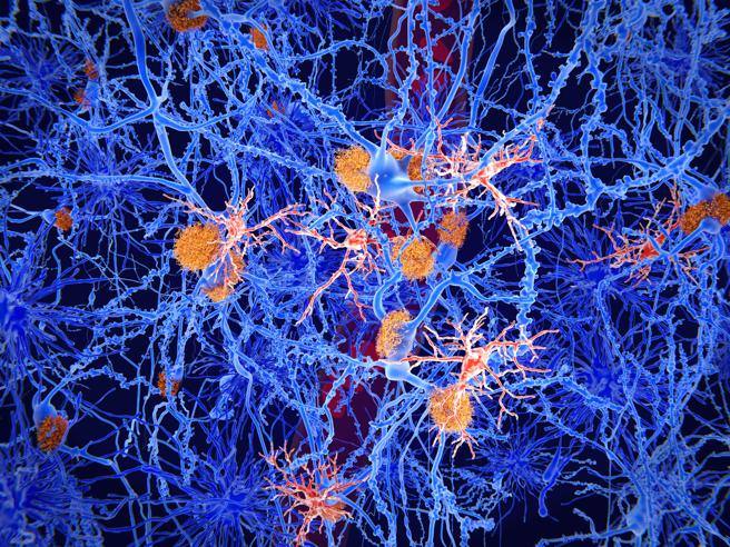 Alzheimer, la protéine Kibra pourrait inverser les problèmes de mémoire