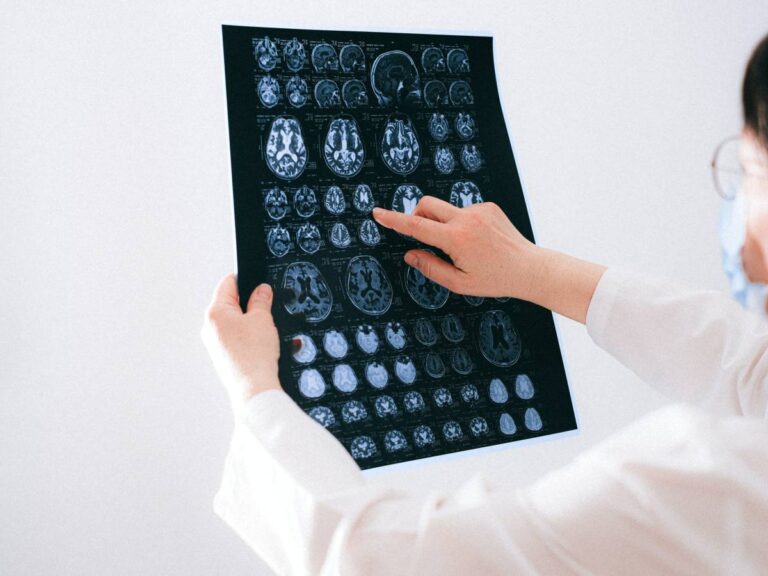 L'intelligence artificielle réduit les risques d'accident vasculaire cérébral et de crise cardiaque